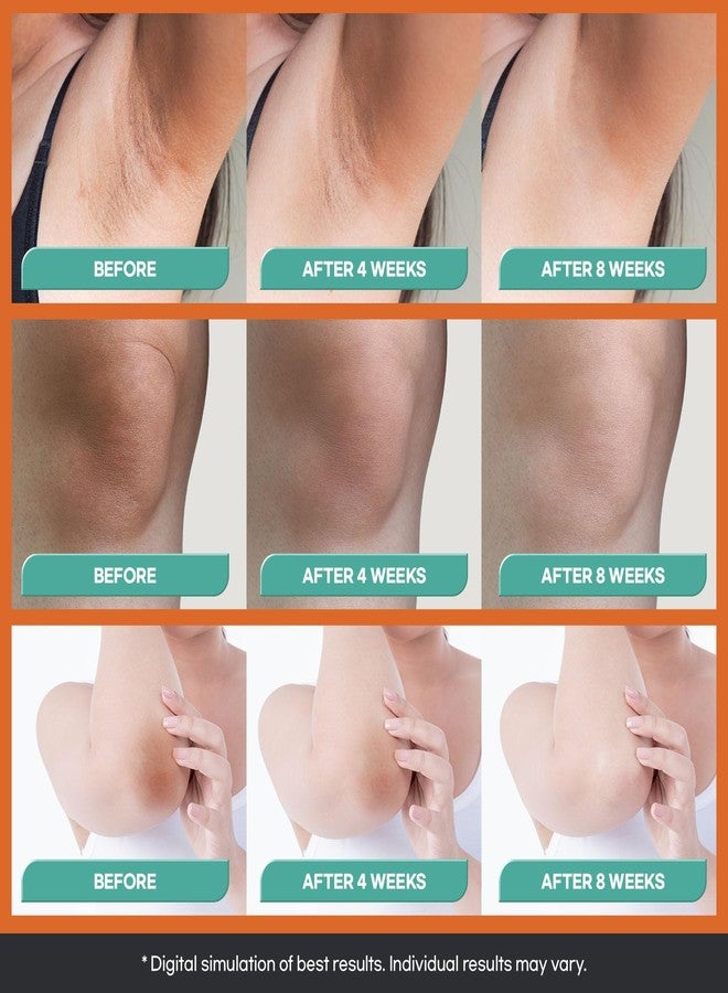 Natural Vine Dark Spot Corrector: Dark Spot Remover for Face and Body - Age Spot Brown Spot Sun Spot Remover Faded Spot Melasma Freckles Correcting - With Niacinamide for Women and Men 60g 2Pcs - Image 5